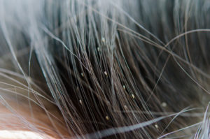 close up of girl's hair with headlice